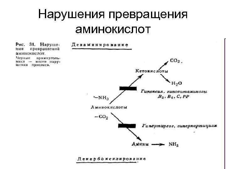 Нарушения превращения аминокислот 