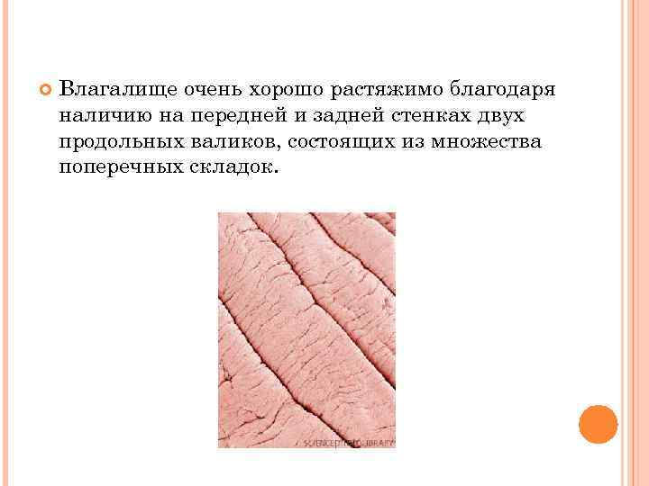  Влагалище очень хорошо растяжимо благодаря наличию на передней и задней стенках двух продольных