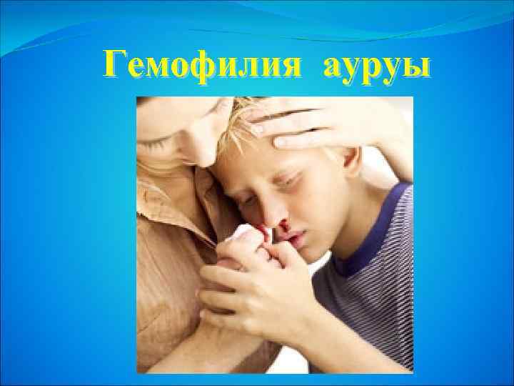 Гемофилия ауруы 