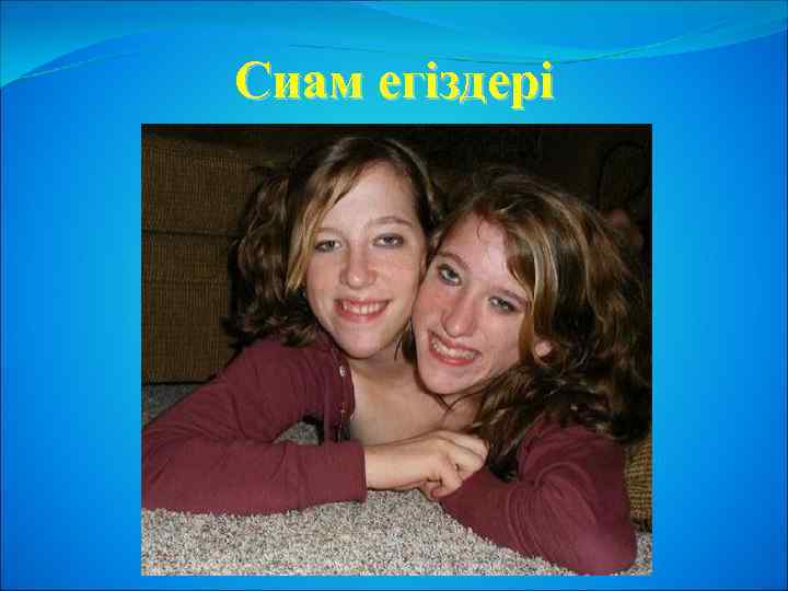 Сиам егіздері 