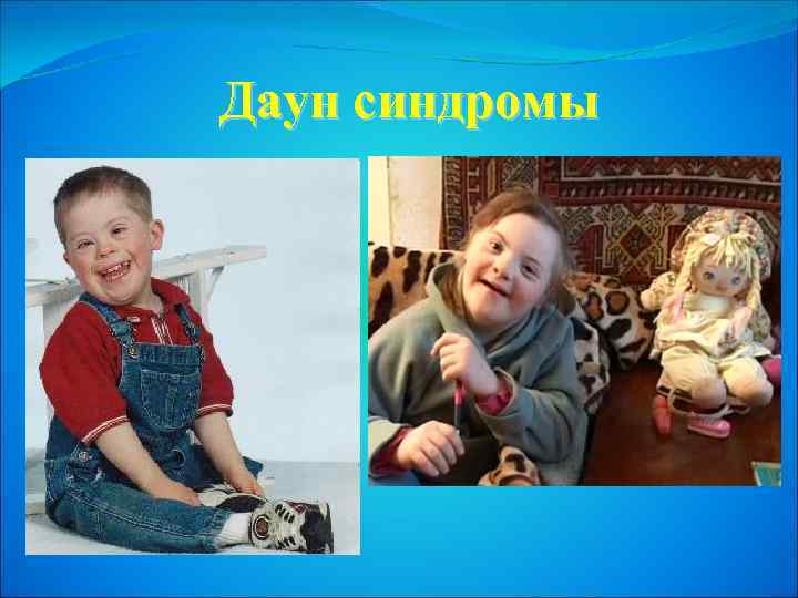 Даун синдромы 