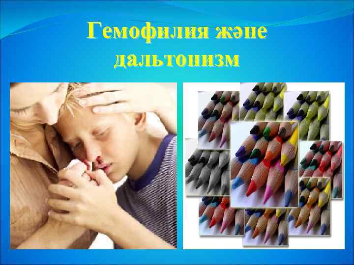 Гемофилия және дальтонизм 