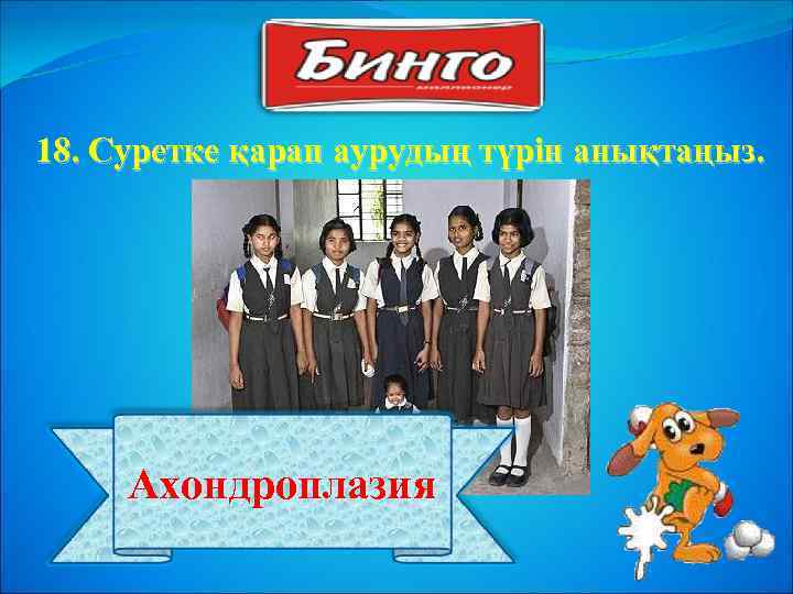 18. Суретке қарап аурудың түрін анықтаңыз. Ахондроплазия 