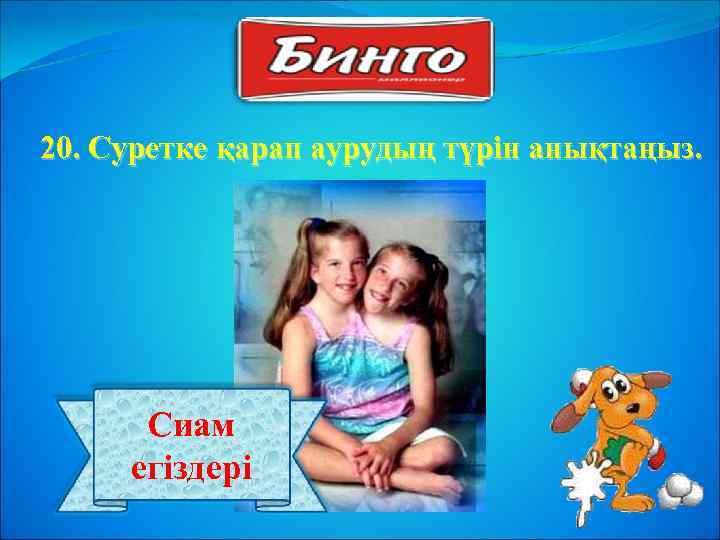 20. Суретке қарап аурудың түрін анықтаңыз. Сиам егіздері 