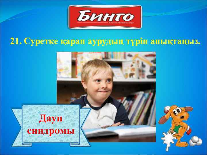 21. Суретке қарап аурудың түрін анықтаңыз. Даун синдромы 