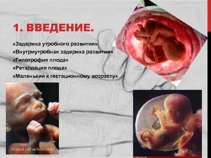 1. ВВЕДЕНИЕ. «Задержка утробного развития» «Внутриутробная задержка развития» «Гипотрофия плода» «Ретардация плода» «Маленький к
