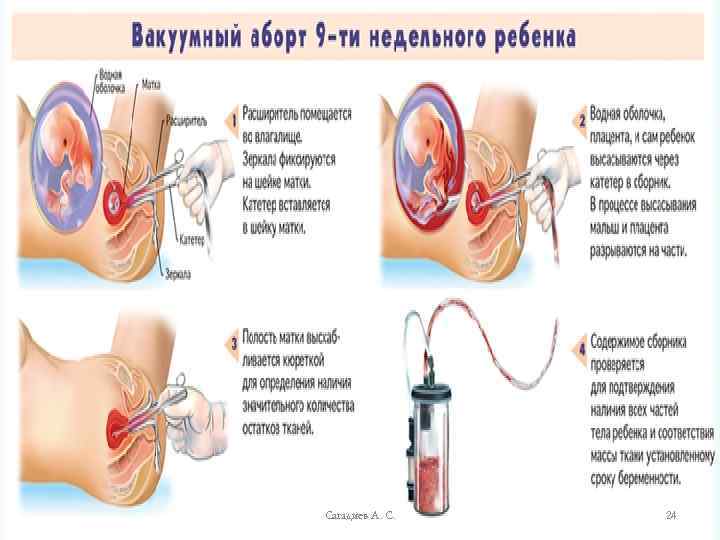 Сагадиев А. С. 24 