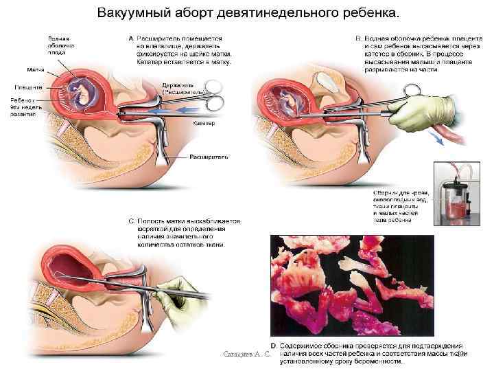 Сагадиев А. С. 29 