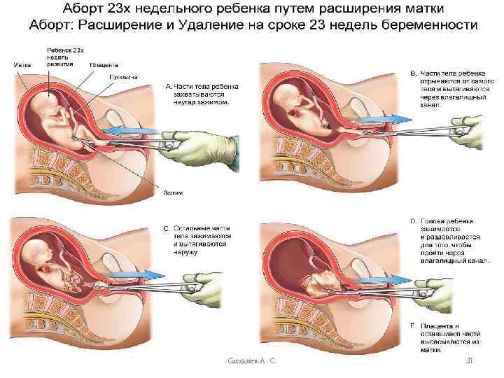 Сагадиев А. С. 31 