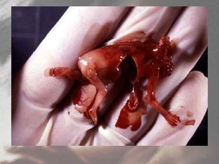 Сагадиев А. С. 32 