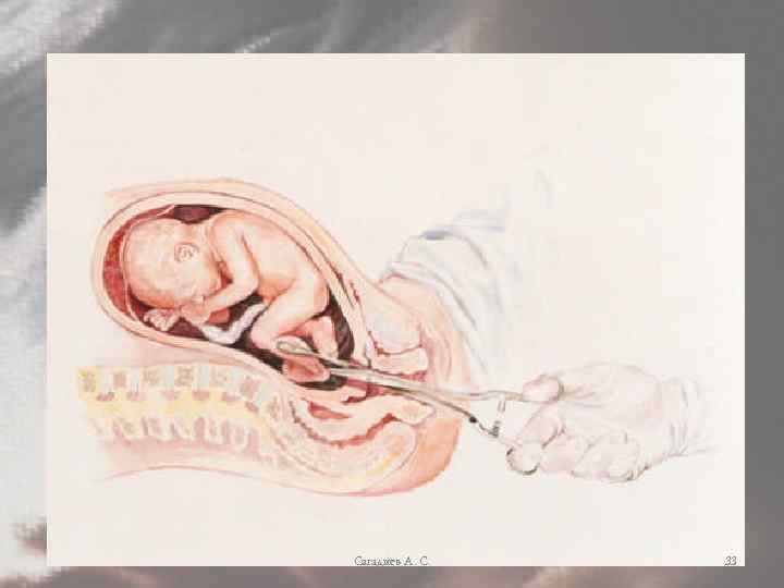 Сагадиев А. С. 33 