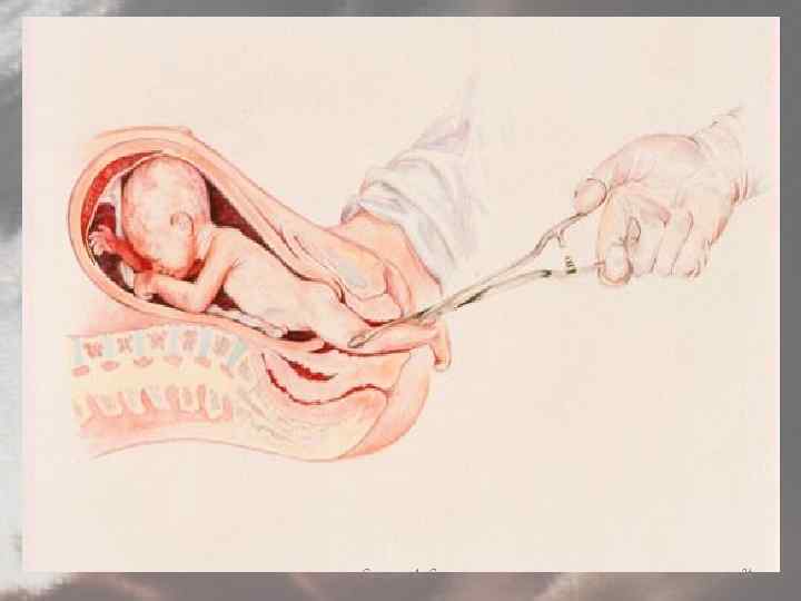 Сагадиев А. С. 34 