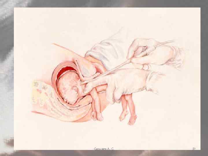 Сагадиев А. С. 37 