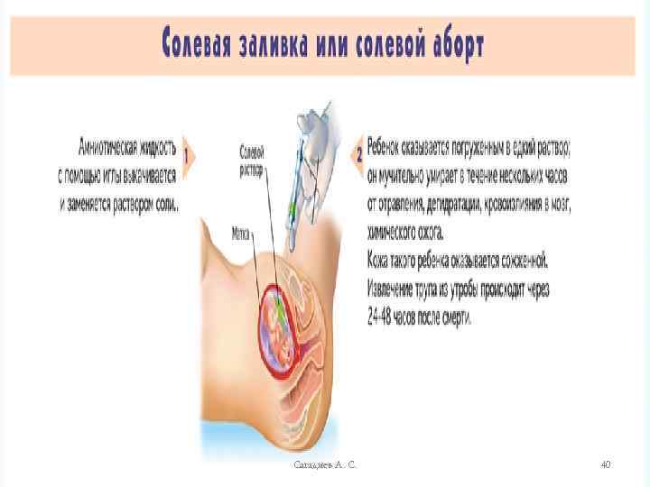 Сагадиев А. С. 40 