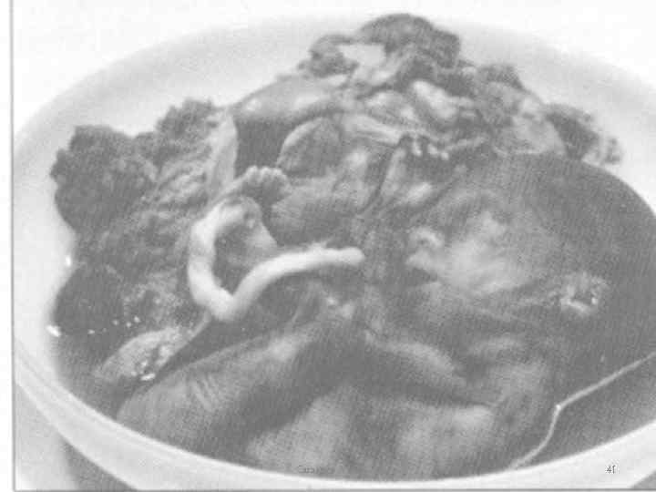 Сагадиев А. С. 41 