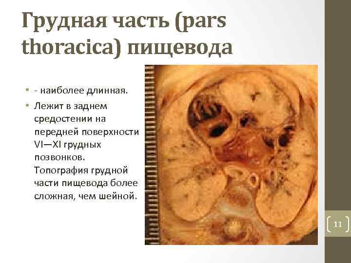 Грудная часть (pars thoracica) пищевода • наиболее длинная. • Лежит в заднем средостении на