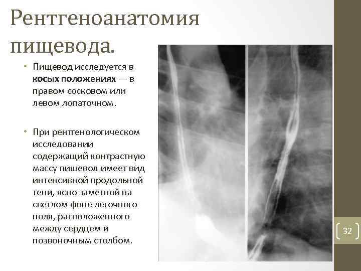 Рентгеноанатомия жкт презентация