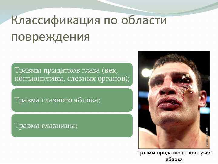 Классификация по области повреждения Травмы придатков глаза (век, конъюнктивы, слезных органов); Травма глазного яблока;