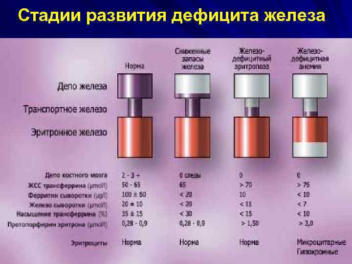 Стадии развития дефицита железа 