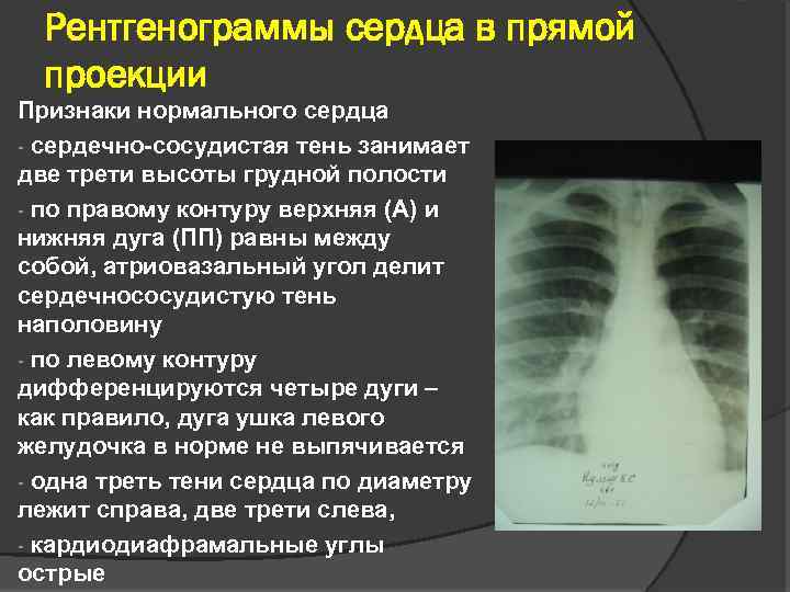 Лучевая диагностика сердечно сосудистой системы презентация