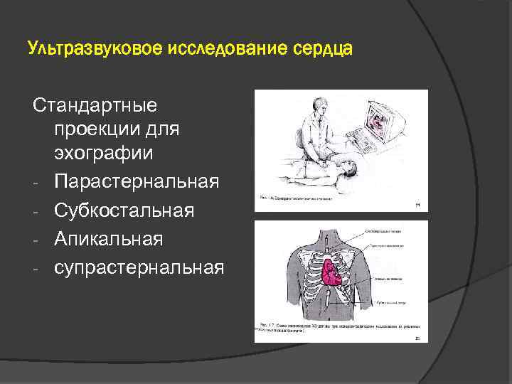 Обследование сердца какие бывают