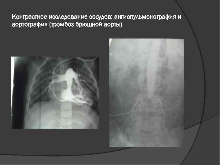 Контрастное исследование