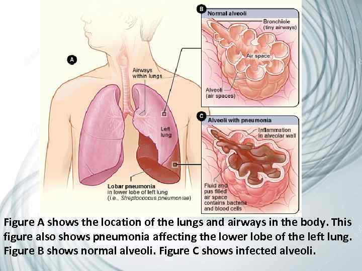 Figure A shows the location of the lungs and airways in the body. This