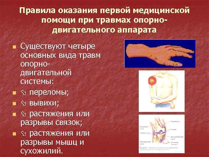 Правила оказания первой медицинской помощи при травмах опорнодвигательного аппарата n n n Существуют четыре