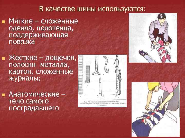 В качестве шины используются: n n n Мягкие – сложенные одеяла, полотенца, поддерживающая повязка