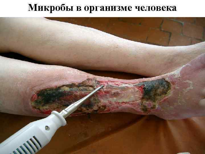 Микробы в организме человека 