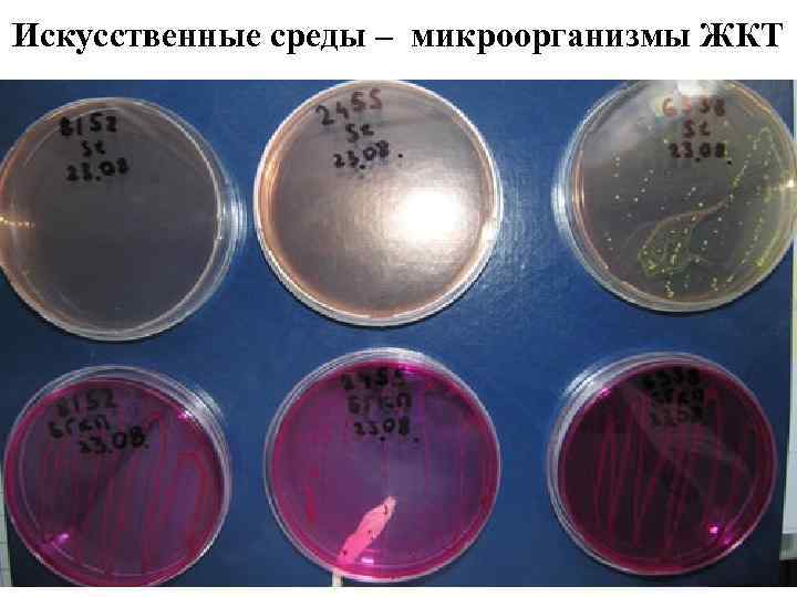 Схемы воспалительную реакцию тканей на внедрение микробов