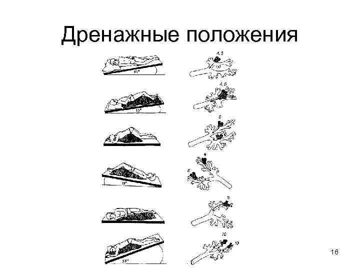 Дренажные положения 16 