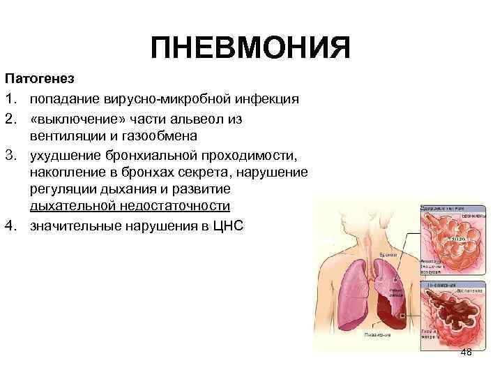 ПНЕВМОНИЯ Патогенез 1. попадание вирусно микробной инфекция 2. «выключение» части альвеол из вентиляции и