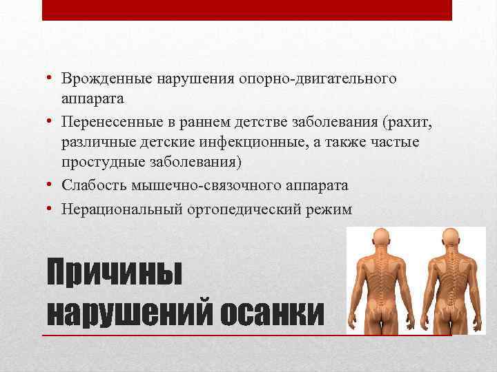  • Врожденные нарушения опорно-двигательного аппарата • Перенесенные в раннем детстве заболевания (рахит, различные
