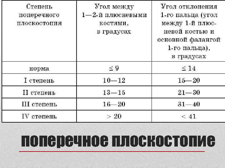 поперечное плоскостопие 