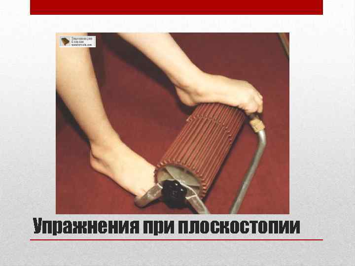 Упражнения при плоскостопии 