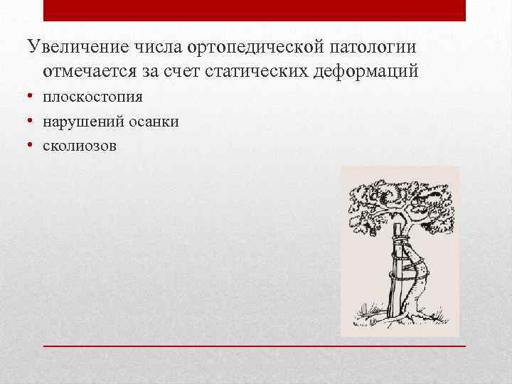 Увеличение числа ортопедической патологии отмечается за счет статических деформаций • плоскостопия • нарушений осанки