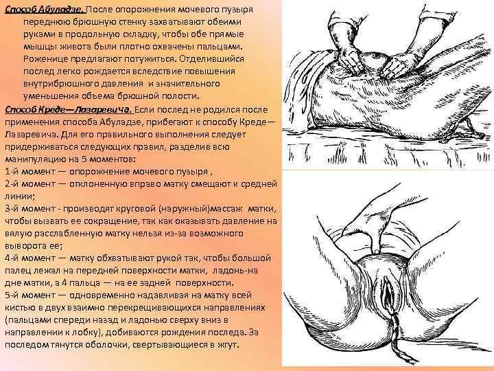 Способ Абуладзе. После опорожнения мочевого пузыря переднюю брюшную стенку захватывают обеими руками в продольную