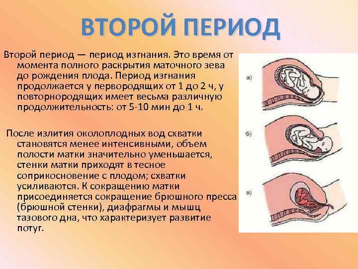 Следующие периоды. Второй период родов изгнание плода. Период изгнания плода кратко. Период изгнания раскрытие маточного зева.