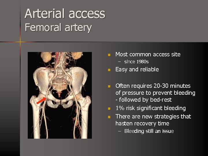 Arterial access Femoral artery n Most common access site – since 1980 s n