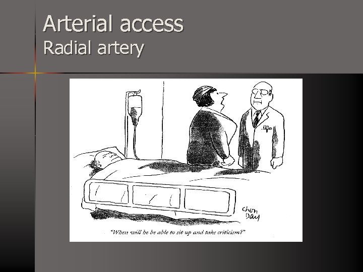Arterial access Radial artery 