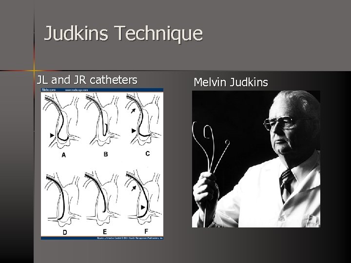 Judkins Technique JL and JR catheters Melvin Judkins 