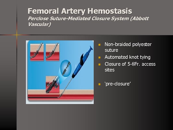 Femoral Artery Hemostasis Perclose Suture-Mediated Closure System (Abbott Vascular) n n Non-braided polyester suture