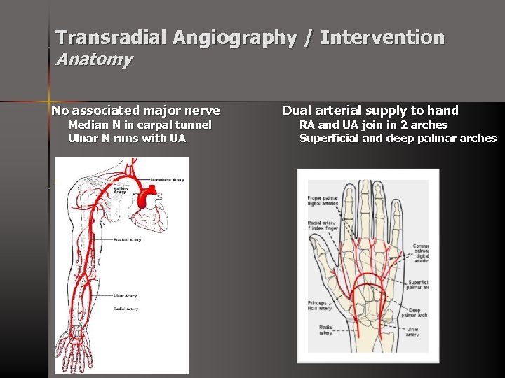 Transradial Angiography / Intervention Anatomy No associated major nerve Median N in carpal tunnel