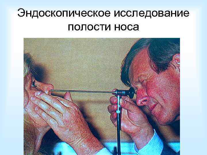Эндоскопическое исследование полости носа 