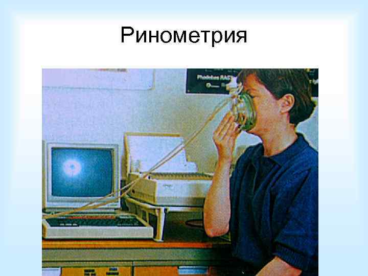 Ринометрия 