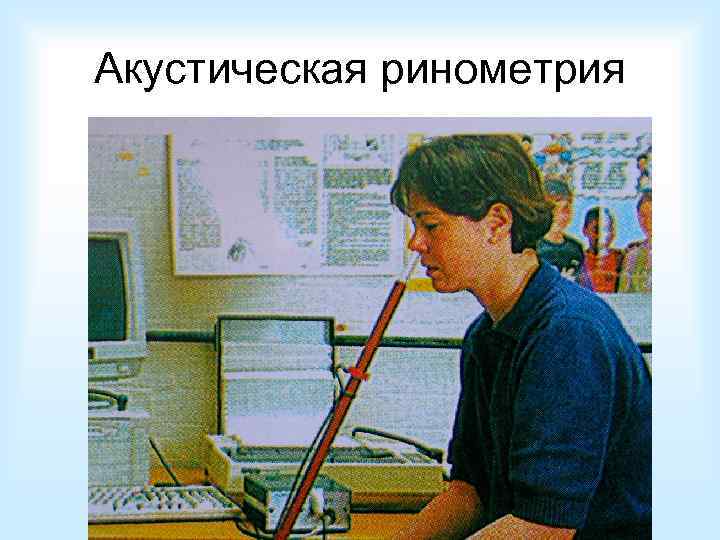 Акустическая ринометрия 