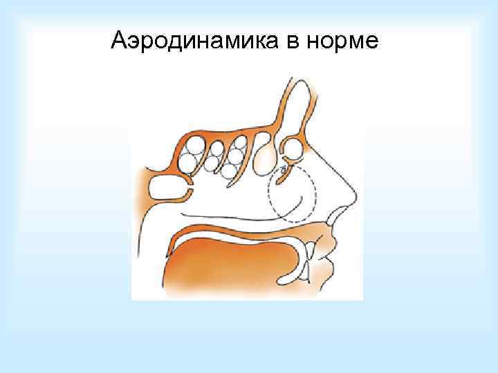 Аэродинамика в норме 