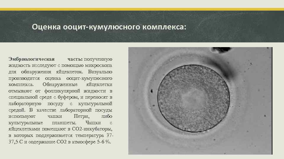 Оценка ооцит-кумулюсного комплекса: Эмбриологическая часть: полученную жидкость исследуют с помощью микроскопа для обнаружения яйцеклеток.