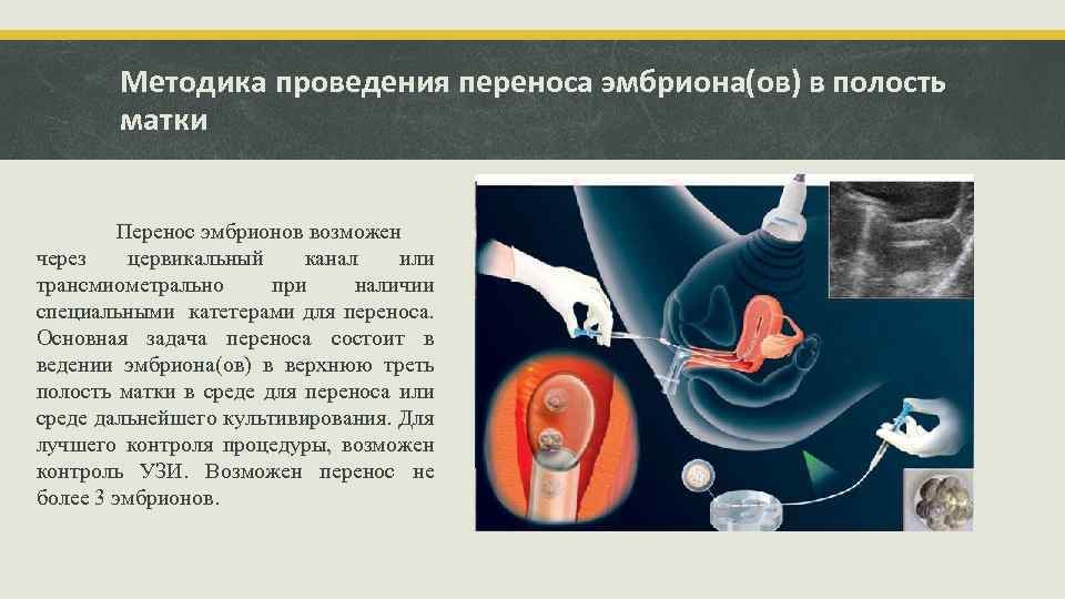 Методика проведения переноса эмбриона(ов) в полость матки Перенос эмбрионов возможен через цервикальный канал или